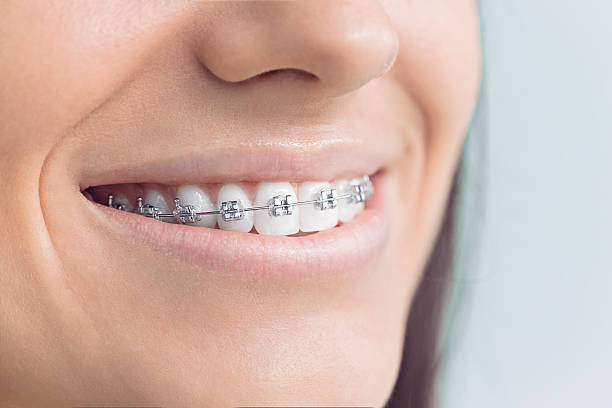 Trusted Potosi, TX Dental Services Experts